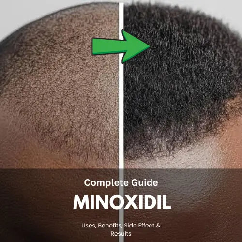 Hair Growth Minoxidil: A Complete Guide to Effective Results urbanluxecare